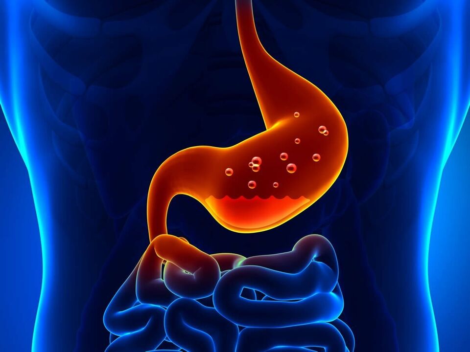 La gastritis es una enfermedad inflamatoria del estómago que requiere una dieta